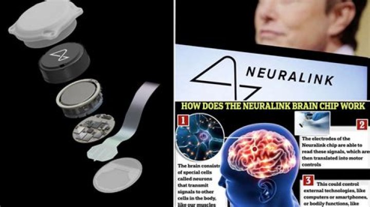 
How does Neuralink work? Elon Musk gets go-ahead from FDA for human testing of brain implants 